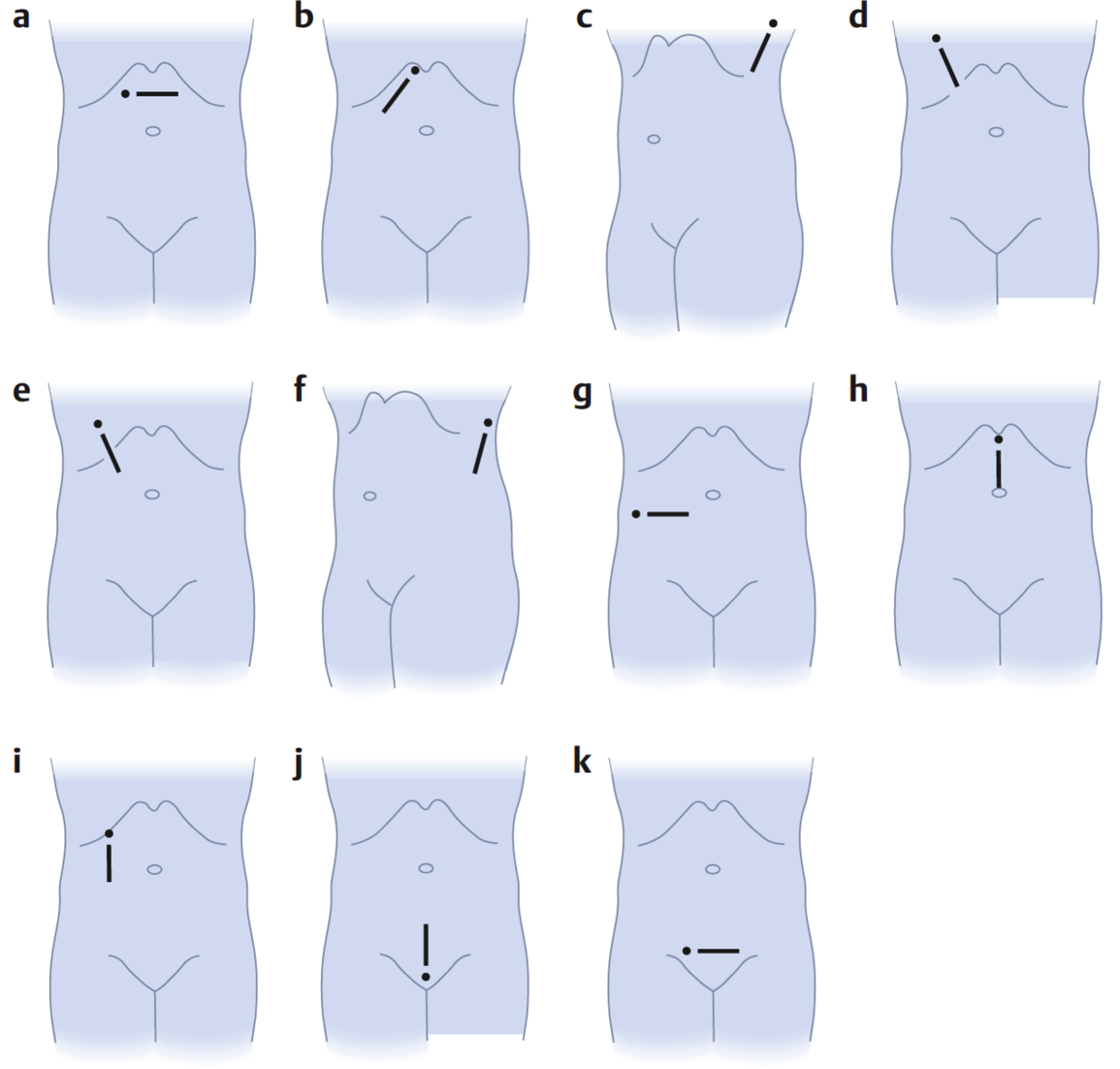 3. ábra. Fő leképezési síkok. a. Transzverzális vagy horizontális sík. b. Longitudinális vagy szagittális sík. c. Koronális vagy frontális sík. Standard síkok.