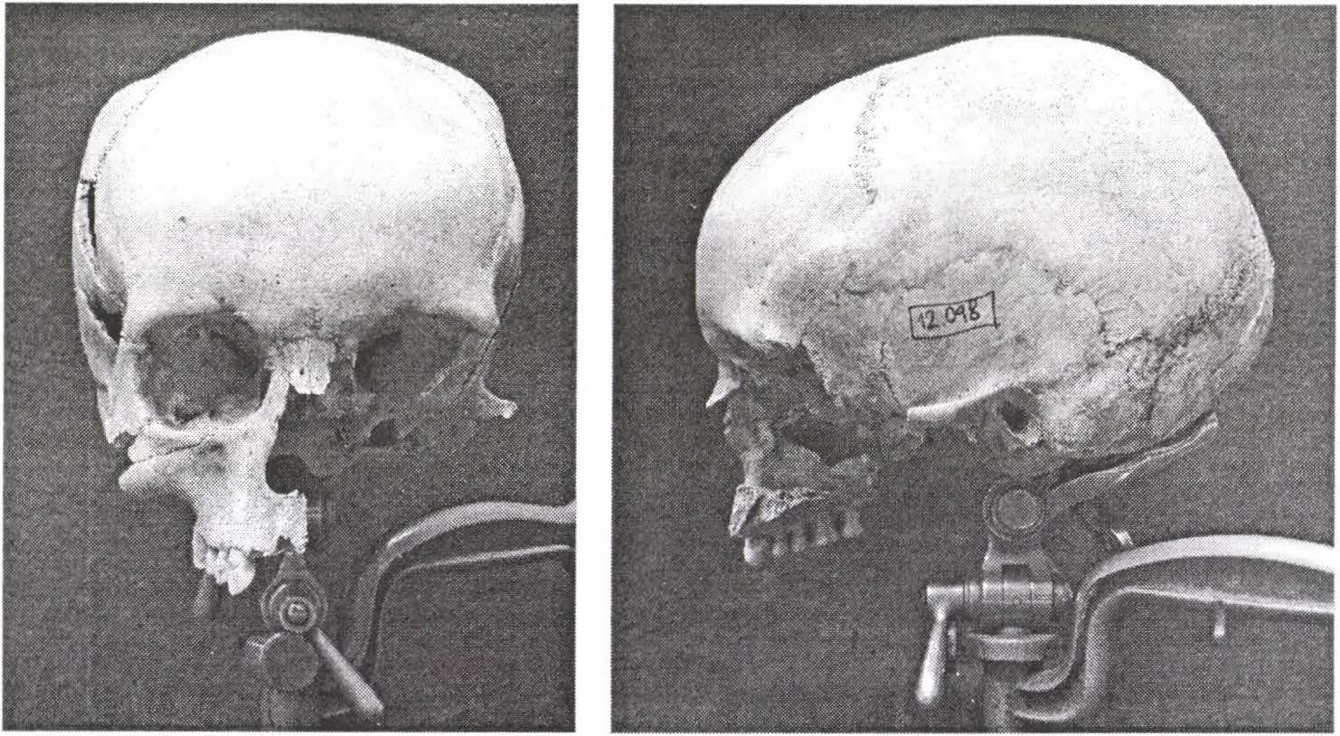 3. ábra: 12. sír, adultus nő (elöl- és oldalnézet). Figure 3: Grave 12, adult female (frontal and lateral view). 4.