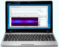 ELŐPROGRAMOZOTT STANDARD PARAMETER KÉSZLETEK VDSL 2 (ITU-T G.993.2) 35 MHz 998-E35-M2x-A 998-ADE35-M2x-A 998-ADE35-M2x-M 998-ADE35-M2x-B 998-ADE35-M2x-BV (vektorozott kábelekhez) VDSL 2 (ITU-T G.993.2) Over ISDN 998-M2x-B8 998-M1x-B 998-M2x-B 998-M2x-B-17 998-M2x-B-17V (vektorozott kábelekhez) VDSL 2 (ITU-T G.