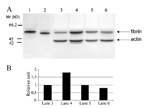 3. A P-selectin glycoprotein ligand-1 (PSGL-1) knock out, egér modellben leírtuk, hogy a PSGL-1 hiánya protektív szereppel bír a thrombosis kialakulása során (Miszti- Blasius et al.