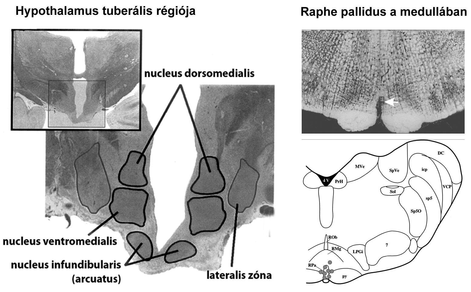 A hypothalamus dorsomedialis magjának