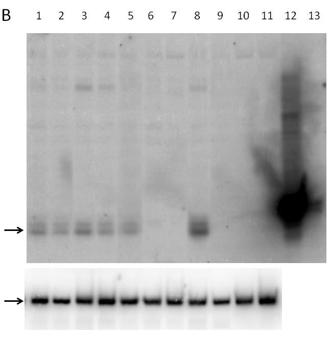 A B 14. ábra Az érett mir-146a mennyisége Northern blot módszer eredményeként kapott futtatási képen.