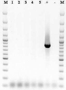 4. Eredmények Minden vizsgált nyálkaspórás minta esetében, a használt primerpártól függően sikerült felsokszoroznunk a 18S rdns különböző méretű szakaszát két körös (nested) PCR segítségével.