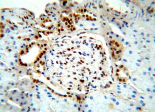 Protein asszociált O-glcNAc detektálása immunhisztokémiával O-GlcNac mintázat cardiomyocytákban - Immunfluoreszcencia Nagy T, Champattanachai V, Marchase RB, Chatham JC.