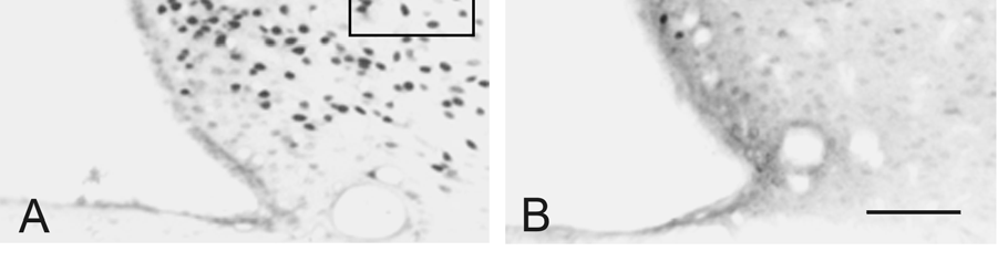4. EREDMÉNYEK 4.1. 17ß-ösztradiol hatása az anteroventrális periventriculáris nucleus (AvPv) ösztrogén receptort expresszáló neuronjainak szinapszisaira Az irodalmi adatokkal megegyezően (Langub, Jr.