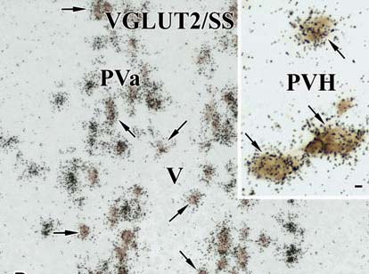 2. Folytattuk az általunk feltárt jelenség - a hypothalamus neuroszekretoros rendszereit jellemző glutamáterg fenotípus vizsgálatát.