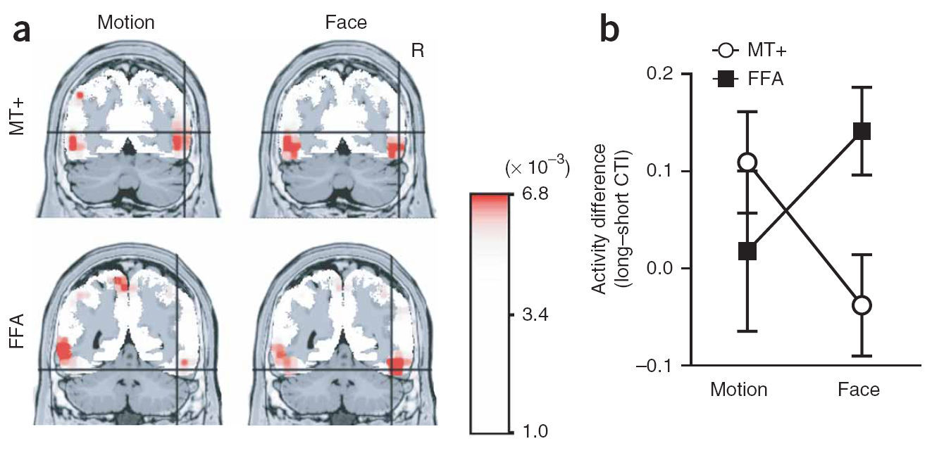 A top-down figyelmi moduláció befolyásolja az agyi aktiváció irányát transcranialis mágneses