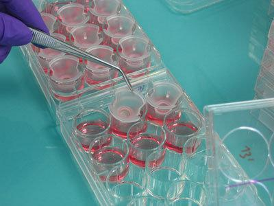 LAB Research In vitro tesztek EpiSkin: Rekonstruált humán epidermisz A bőrre