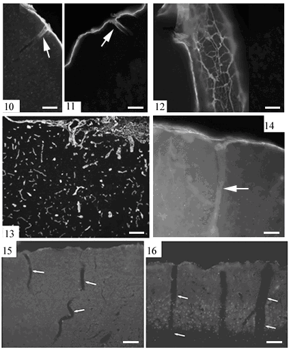 10-11. ábra: Intakt agyban az ereknek csak a belépő része (nyíl) laminin-immunpozitív. Skála: 100 μm. 12. ábra: Agyburok kiterítve: az erek erősen laminin-immunpozitívak. Skála: 100 μm. 13.