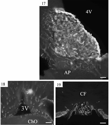 17-19. ábra: Cirkumventrikuláris szervek, amelyekben az erek laminin-pozitívak. 17. ábra: Area postrema AP). (4V-4. kamra). Skála: 80 μm. 18.