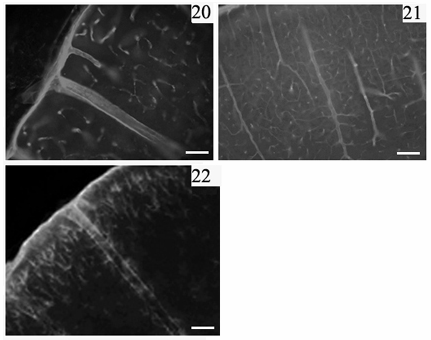 20-21. ábra: Agyi erek a β-disztroglikán immunfestése nyomán. A meningeális erek nem jelölődtek, ellentétben a laminin immunfestésével. Az agyi érhálózat jól kirajzolódik. Skála: 40 ill. 100 μm. 22.