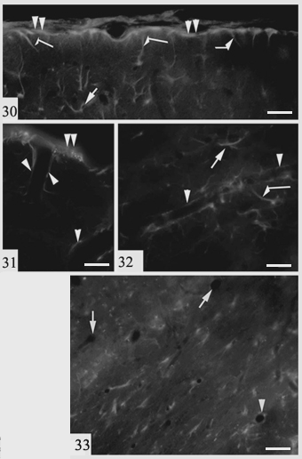 30. ábra: A meningeális felszín mentén az 5f3-immunpozitivitás kirajzolja a glia limitanst (dupla nyílhegy), a glianyúlványokat és a végtalpakat (megtört nyílak) csakúgy, mint az asztrocitákat a