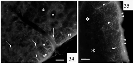 34-35. ábra: Az agytörzsi strukturákban a glia limitans erősebb 5f3-jelölődést mutat (kettős nyílhegy), a felszíni glia nyúlványai hosszabbak (nyílhegy).