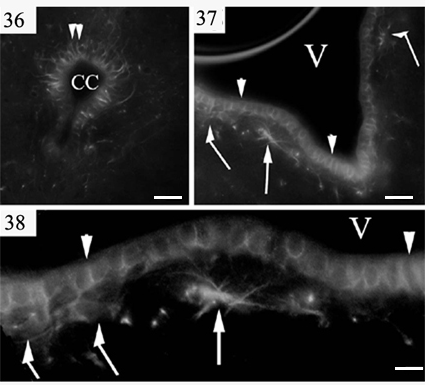 endokrin hypothalamus magok (nucleus supraopticus, nucleus paraventriculáris), vagy a cirkadián ciklust szabályozó nucleus suprachiasmaticus, nem voltak immunpozitívak, de a felszínre merőleges