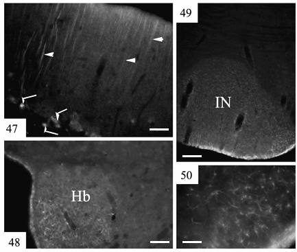 47. ábra: A Bergmann gliát leginkább a meningeális felszín közelében jelölték az 5f3 antitestek (nyílhegy), a Purkinje-sejteket a megtört nyílak jelölik. Skála: 60 μm. 48.