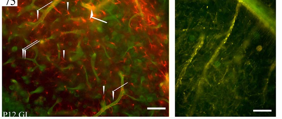 Laminin-pozitív erek láthatók a GFAP-pozitív asztrocitákat (nyílhegy) tartalmazó területeken is. Számos asztrocita kapcsolódik az erekhez (figyeljük meg a sárga területeket, nyílak). Skála: 100 μm.