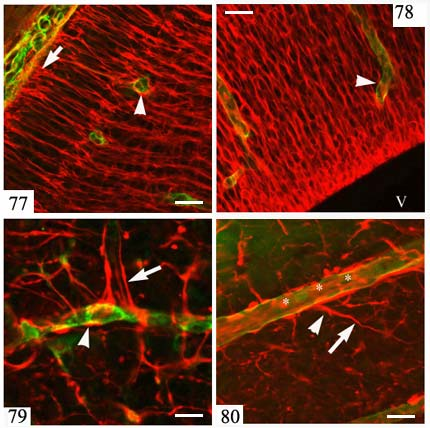 ábrák). Ezek a vizsgálatok mutatták, hogy a 16. embrionális napon az ereken még nem láthatók glia végtalpak (77-78. ábrák), viszont a 18. napon már azonosíthatók (79. ábra), és a 20.