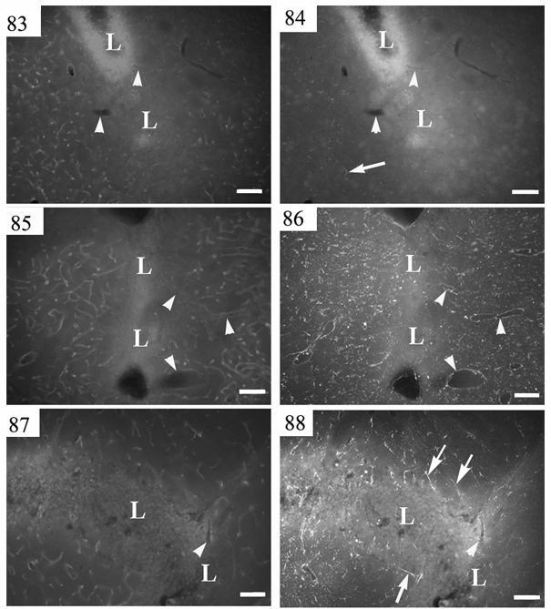 83-88. ábra: A gliareakció kiterjedése a 2. (83-84. ábrák) a 4. (85-86. ábrák) és a 7. (87-88. ábrák) posztoperativ napon a sérülés (helyét L jelzi) után. Kettős jelzés azonos metszeteken, 83., 85.