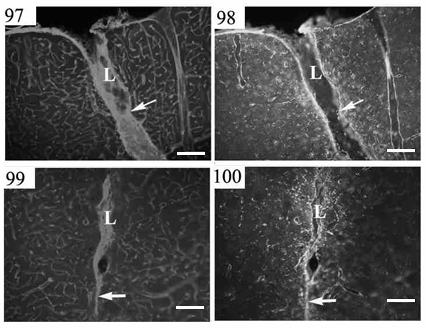 97-100. ábra: 4: A végleges gliaheg létrejötte. 21. ill. 35. posztoperativ napok, 97., 99. ábrák: β-disztroglikán, 98., 100. ábrák: GFAP immunfestése (L: sérült terület, nyíl: az új glia limitans).
