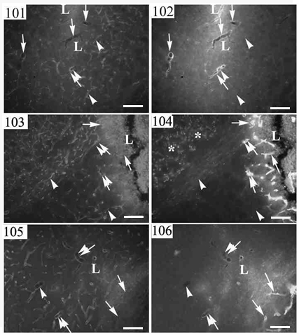 101-106. ábra: A β-disztroglikán (101., 103., 105. ábrák) és a laminin-immunreaktivitás (102., 104., 106. ábrák) összehasonlítása az agyi erekben sérülés hatására.