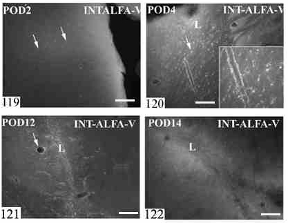 Sérülést követően a második posztoperatív napon az integrin-αv-immunpozitítás neuronokban kimutatható, asztrocitákon nem (119. ábra). 119-122. ábra. Integrin αv-immunpozitivitás sérülés hatására: 119.