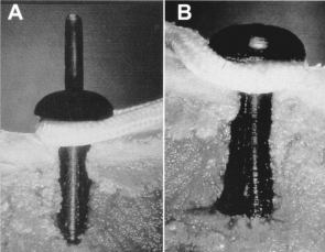 4. ábra A tibia distalis metaphysis metszete A: A patent összezárt B: Szétfeszített nyúlványokkal mutatja a corticalis csontban való rögzülés elvét.