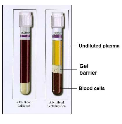 BD Vacutainer PPT TM Plazma Preparáló csı Felhasználás: Molekuláris diagnosztikai tesztek (pl.