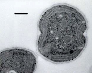 A Bürker-kamrás sejtszámlálás is hasonló eredményt adott: két hét PG-éheztetés után a sejtszám nem nőtt, a sejtosztódás leállt (12/B ábra), majd a PG-éhezés 4. hetében a kultúra elpusztult.