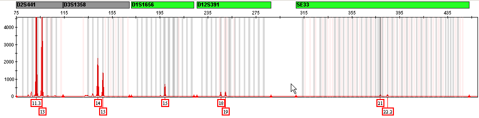 Ismeretlen holttest