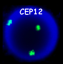 1.3.1 Az immunglobulin (Ig) gének szerveződése Az Ig nehézlánc-gének (IgH) a 14-es kromoszómán, a könnyűlánc-gének (IgL) közül a κ könnyűlánc a