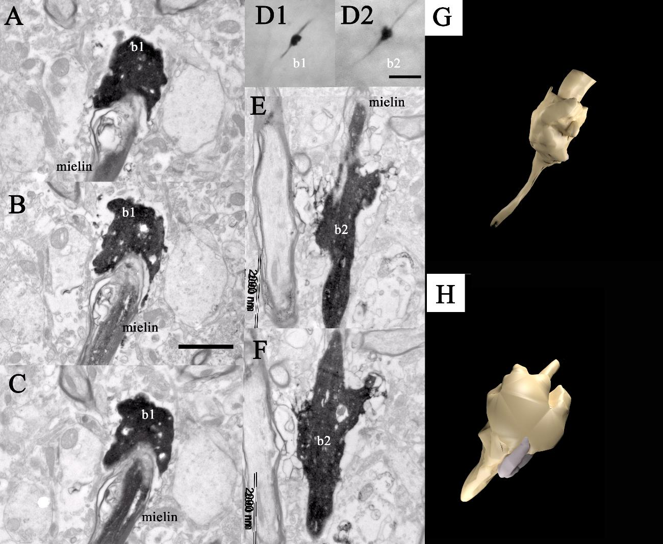 30. ábra. Varikozitások két óriás példánya (Br1 beadás, P). Az óirásboutonok az infragranularis rétegből származnak (1410 µm-re a kérgi felszíntől).