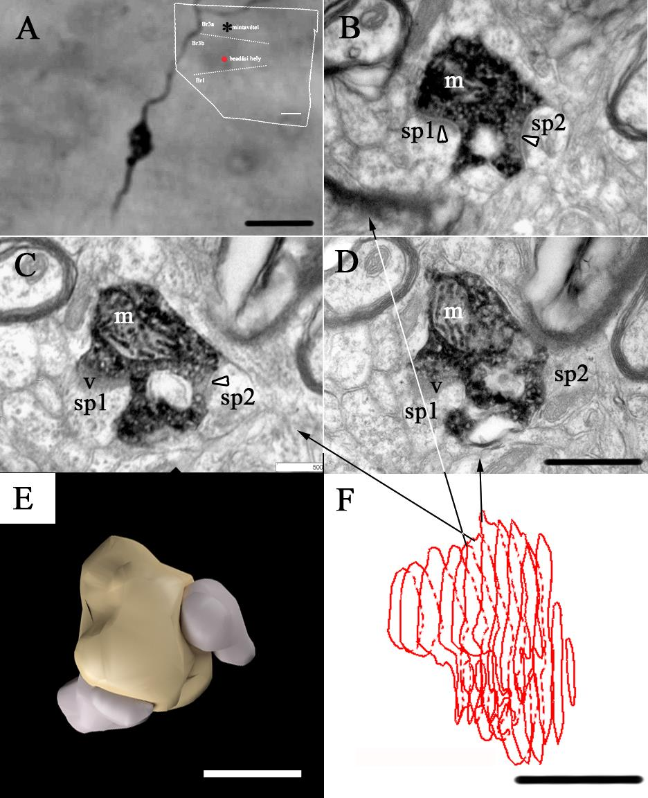 32. ábra. Egy nagy bouton metszeteinek reprezentatív képei Br3a-ból (Br3b beadás, V majom). A: BDA jelölt axonnak és varikozitásának fénymikroszkópos képe.