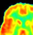 cortex; STN-spinal trigeminal nucleus; SUG-superficial