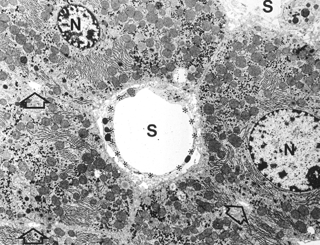 Szövetspecificus kontrasztanyagok RES-specificit specificitás T2 szignálcsökkenés