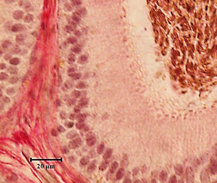 Mellékhere (epididymis) csatornák Van