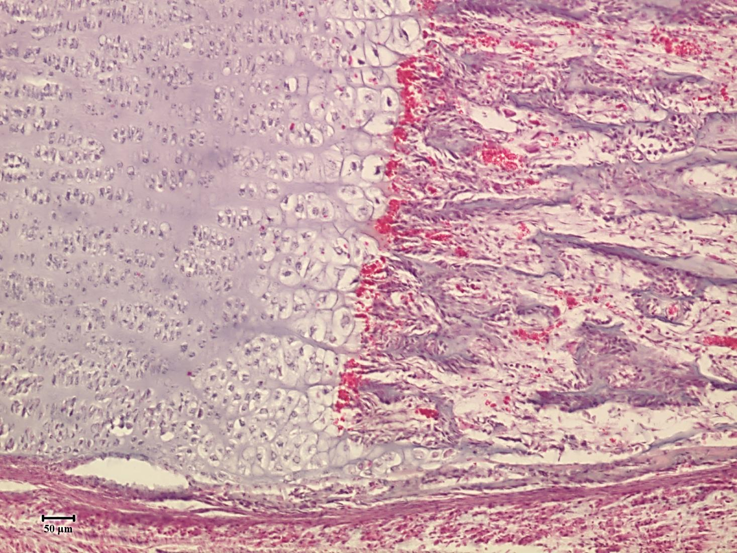 Enchondrális csontosodás- hematoxilin -eosin nyugalmi zóna