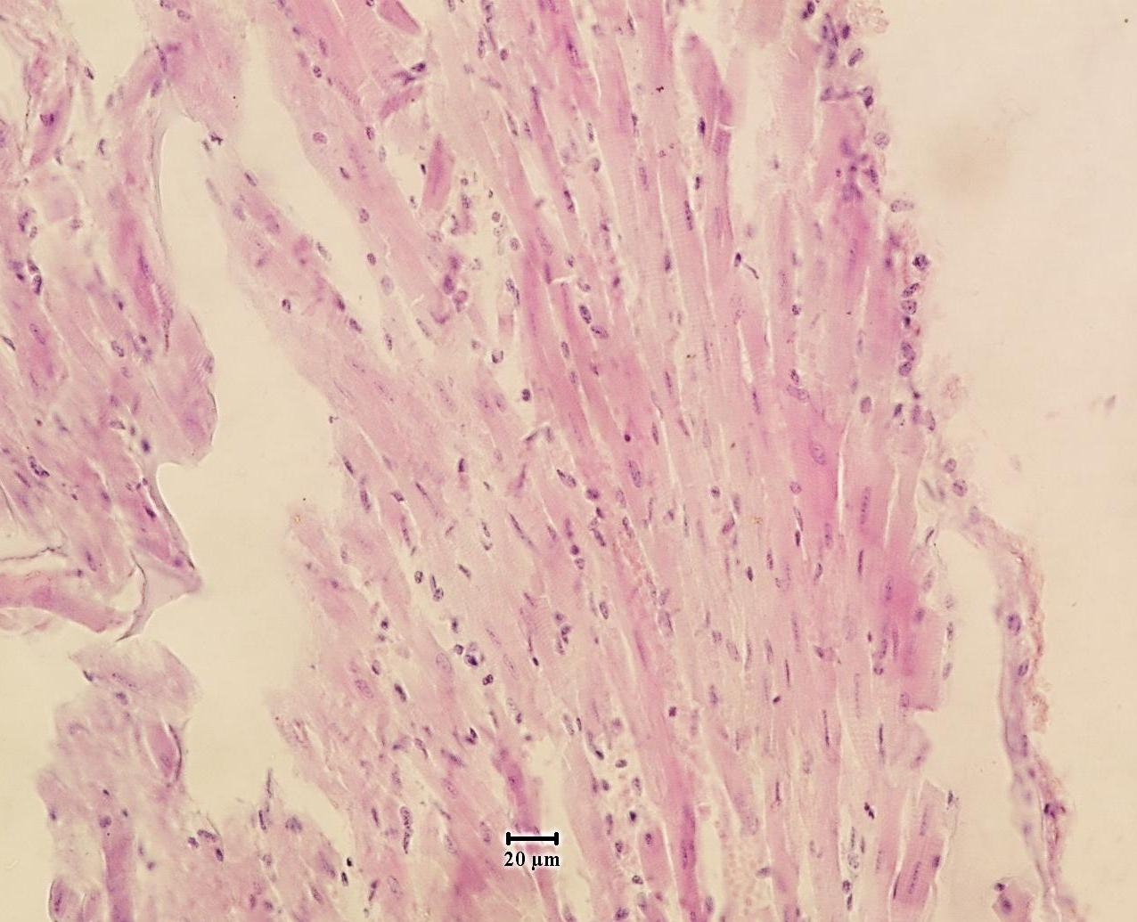 Szívizomszövet - hematoxilin -eosin