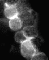 Bevezetés A CD44 molekula adhéziós glikoprotein és idôleges proteoglikán, mely limfoid sejtekben ún. hyaluronsav- és homing receptorként szolgál (CD44s vagy CD44H) (5, 6, 8). Számos ún.