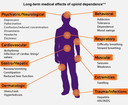 4. Eset Opioid mérgezés 1. Mely NEM tartozik az opiod mérgezés tipikus tüneteihez? A. légzésdepresszió B. hasmenés C. eufória D. tűhegy-pupilla 4. Eset Opioid mérgezés A 30 éves M.