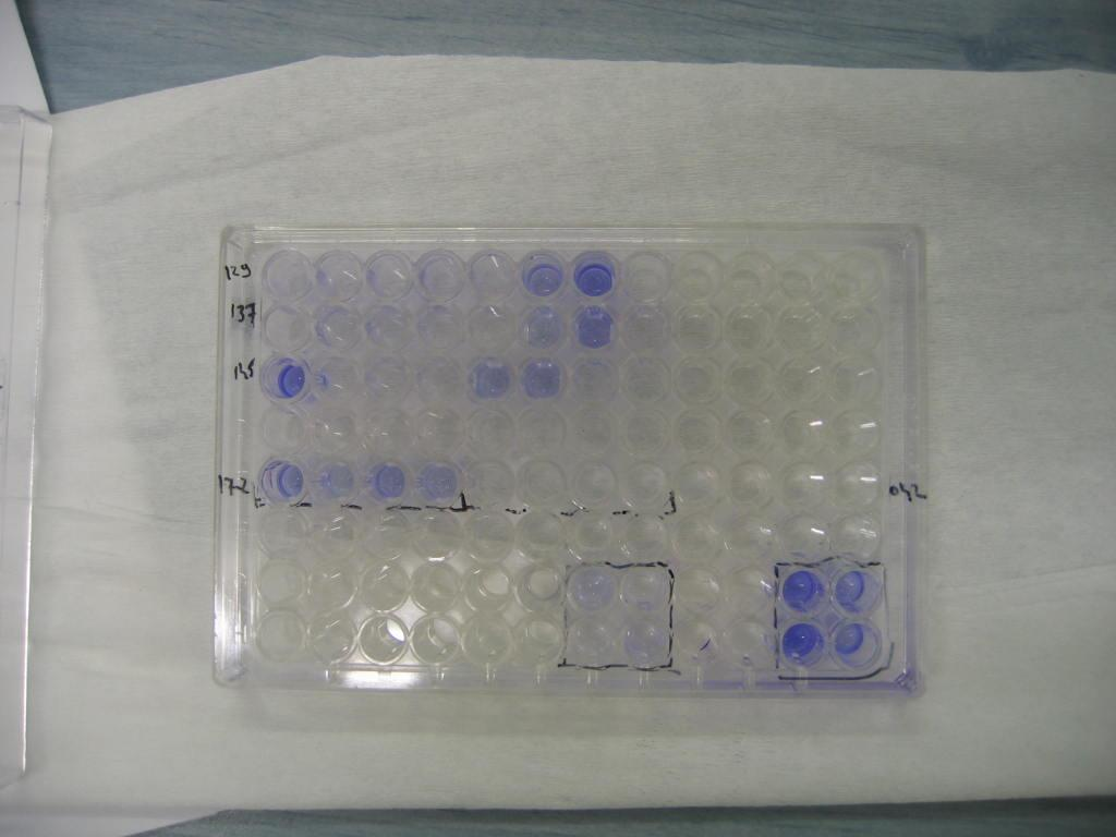 Biofilm assay (Wakimoto N et al, Am. J. Trop. Med.Hyg., 2004 and Bangar R et al Int. J. of Health Sciences, 2007) 129 136 17-2 E.