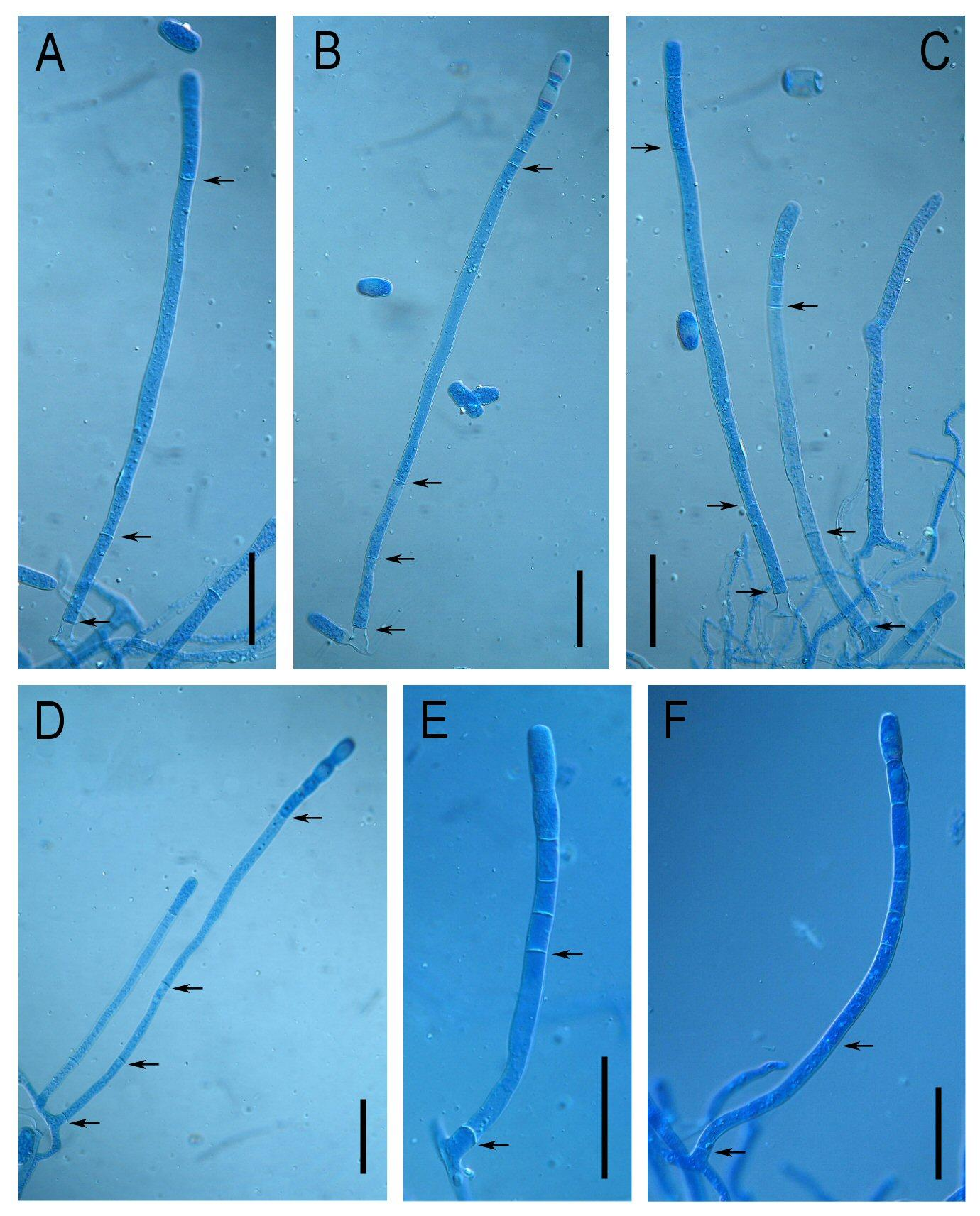 konídiumtartókat, amelyekben a lábsejt rövid (48-67 x 7-9 µm), azt 3-5 hasonló hosszúságú sejt, majd egy kivételesen hosszú sejt (105-181 x 8-10 µm) követi. Ezekben a konídiumtartókban tehát az 5., 6.