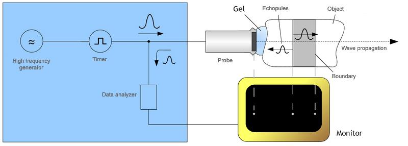 Echopulse 1. ábra Az ultrahangos képalkotás elve.