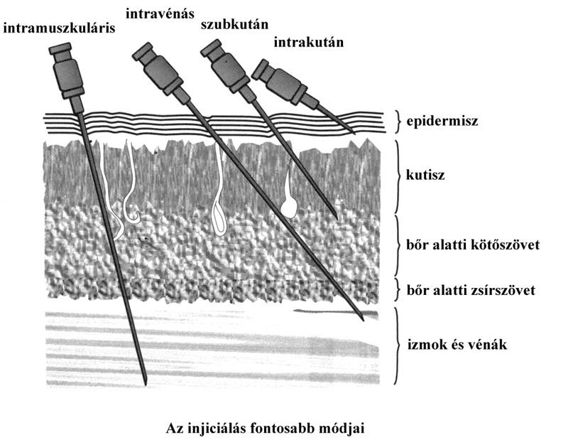 Injekciók,