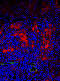 fluoreszcens) endothel sejteket jelölik a C és D ábrán Magfestés
