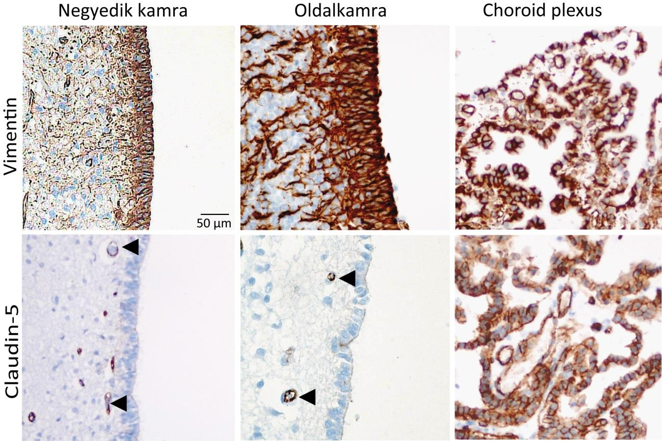 5.7. Nem-endotelialis claudin-5 expresszió a központi idegrendszerben A tumorsejt specifikus claudin-5 jelölődés miatt az agykamrarendszer és gerincvelő központi csatornát borító ependyma szövet