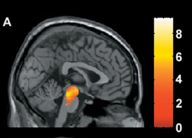 MRI SPECT: a lelet minősége és