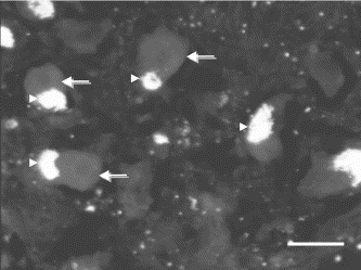 Y-tengely jelöli a sejtek számát. A sejtátmérőn a sejtmagon átvezetett leghosszabb egyenest tekintettük. (A) 5-HT 1B receptor-ir sejtek, (B) 5-HT 1D receptor-ir sejtek.