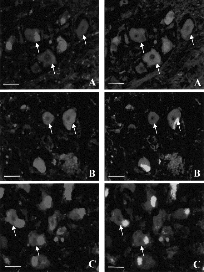 11. ábra (A, B, C).