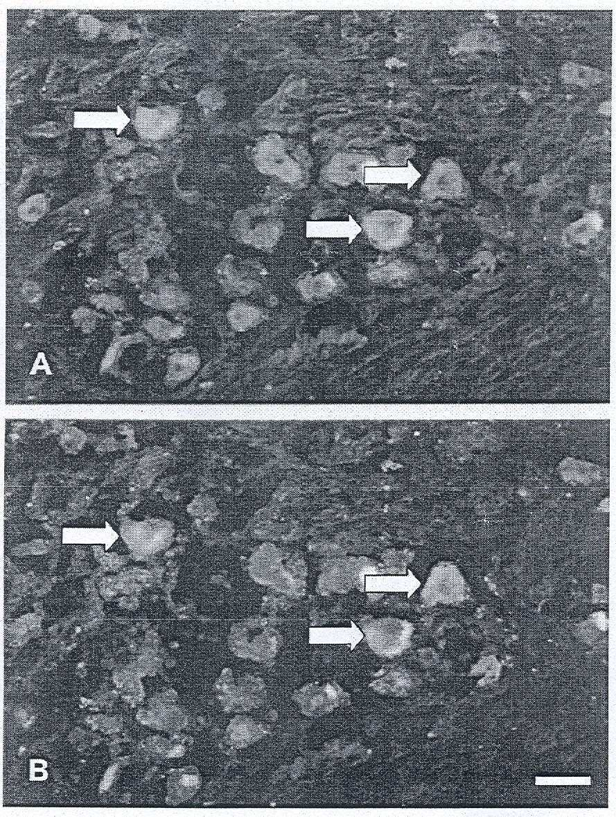 15. ábra (A, B).