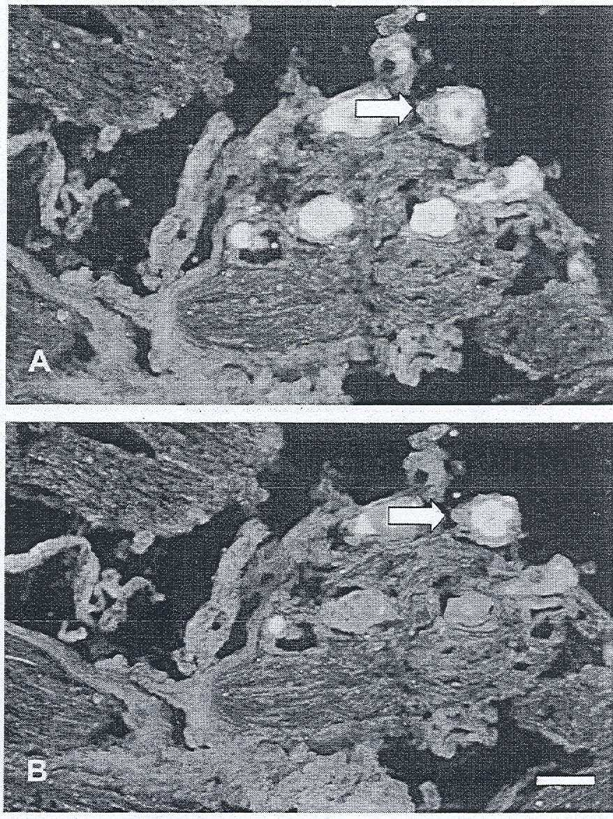 (A) ko-lokalizációja a CGRP-del (B) (nyilak). (Kalibráció: 50 µm) Rövidítések: HO-2: hem-oxigenáz-2, CGRP: calcitonin génnel-rokon peptid, TRIG: ganglion trigeminale 16. ábra (A, B).